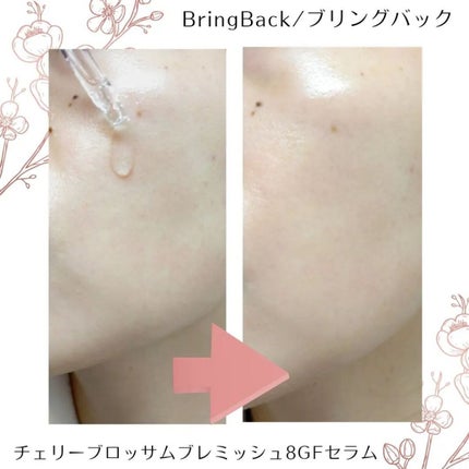 チェリーブロッサムブレミッシュ8GFセラム/Bring Back/化粧水を使ったクチコミ(4枚目)