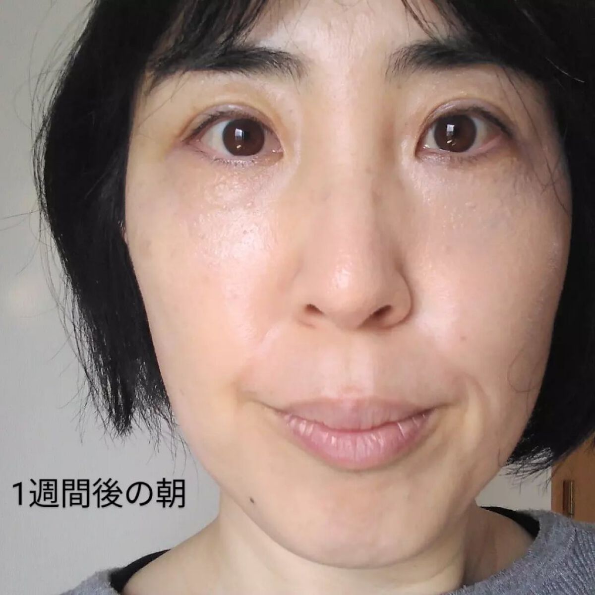 おほあんどうふ on LIPS 「1週間朝に🌄夕に🌇使い続けたら10年前によく見た顔だと驚きまし..」(1枚目)