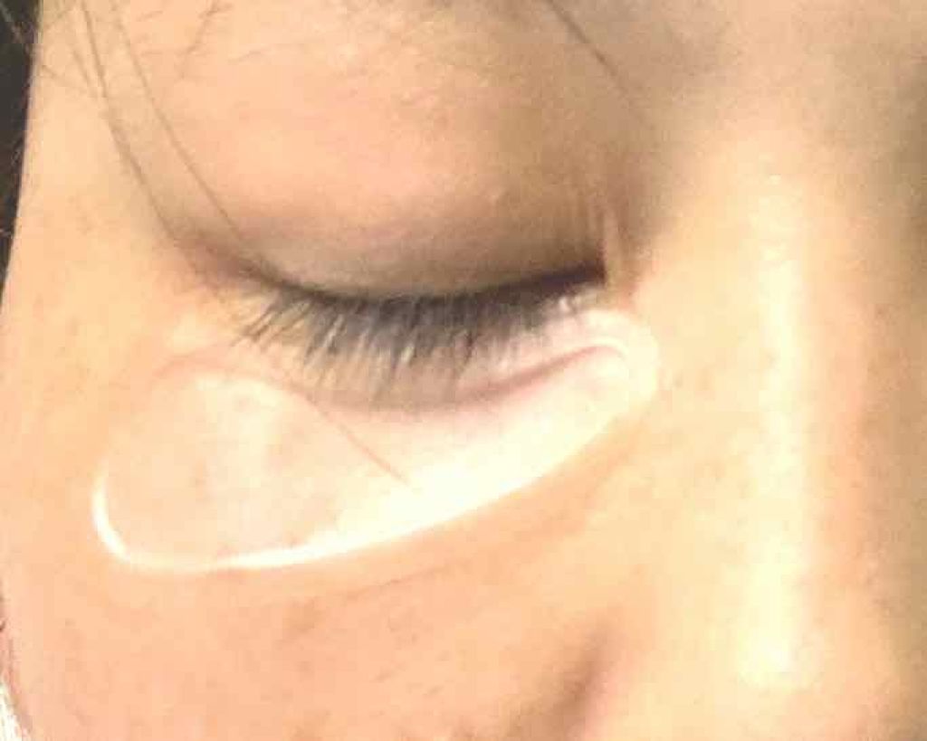 HA フィルパッチ B/ナビジョンDR/美容液を使ったクチコミ（3枚目）