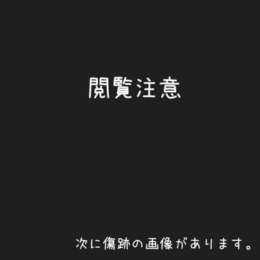 まめゴマ on LIPS 「新しい医療脱毛のクリニックに行ってきました！レナトゥスクリニッ..」（2枚目）