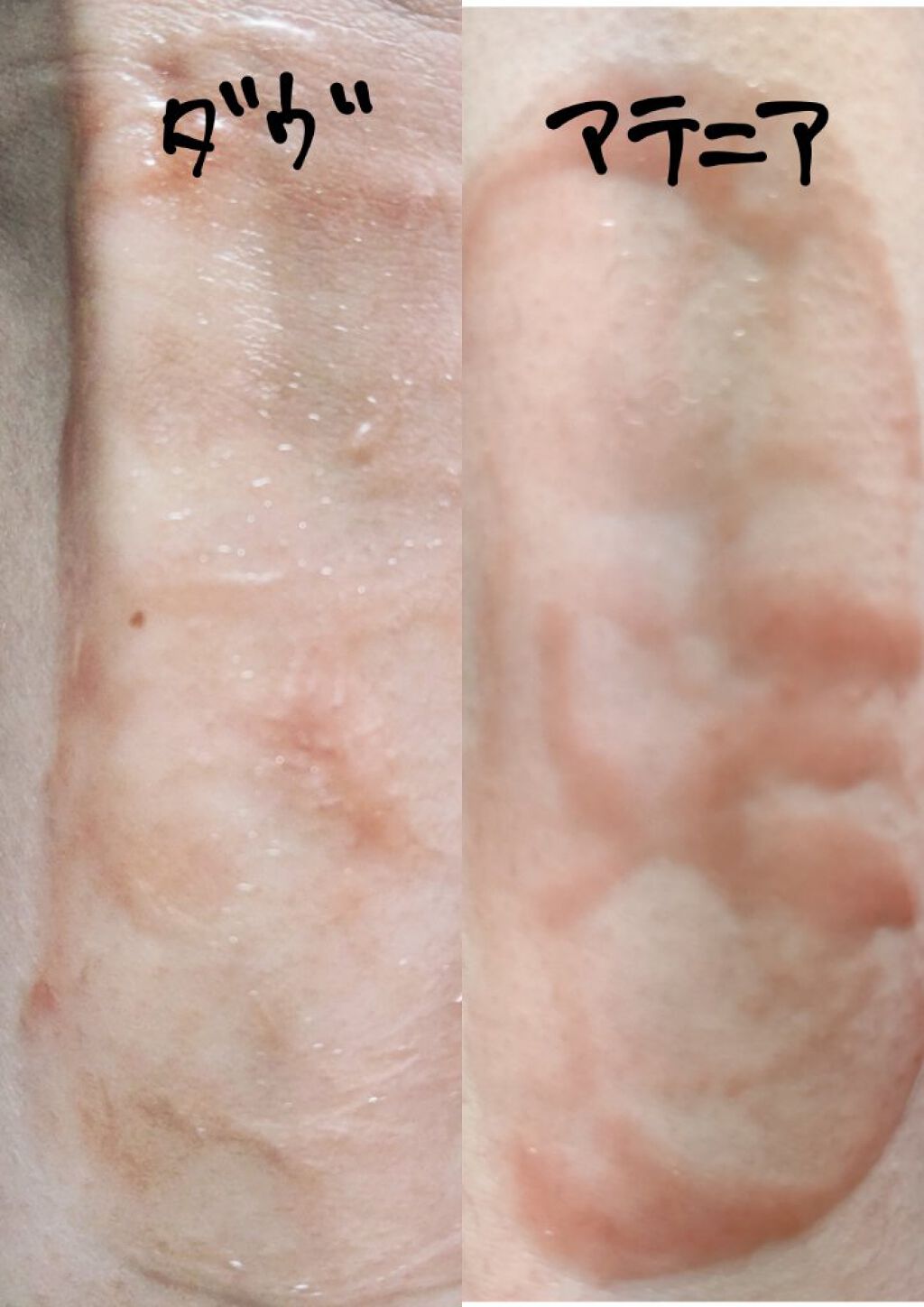 センシティブマイルド ミルククレンジング/ダヴ/ミルククレンジングを使ったクチコミ（3枚目）