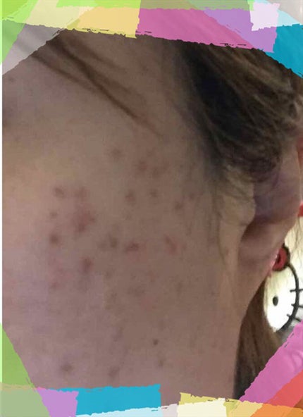 グリーンダーマCICAセラム/ネイチャーリパブリック/美容液を使ったクチコミ(4枚目)