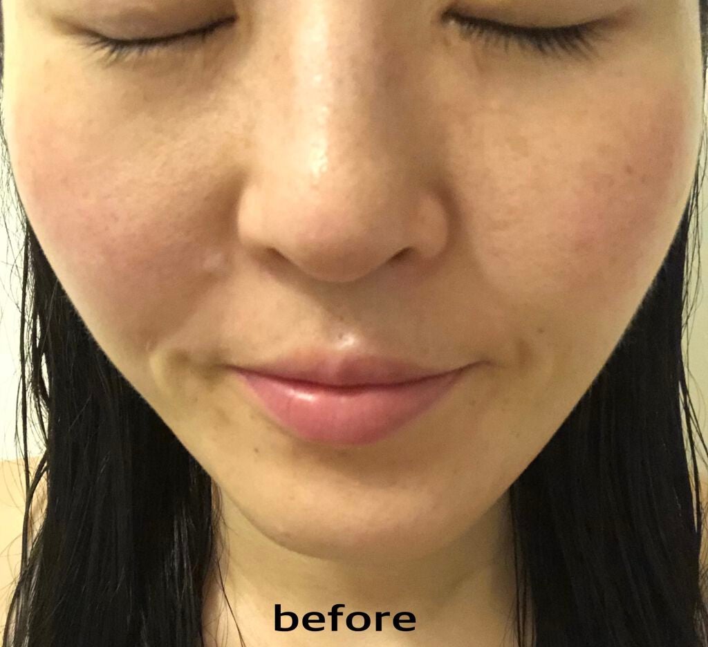 レッドパワー セラム/アイビー/美容液を使ったクチコミ(3枚目)