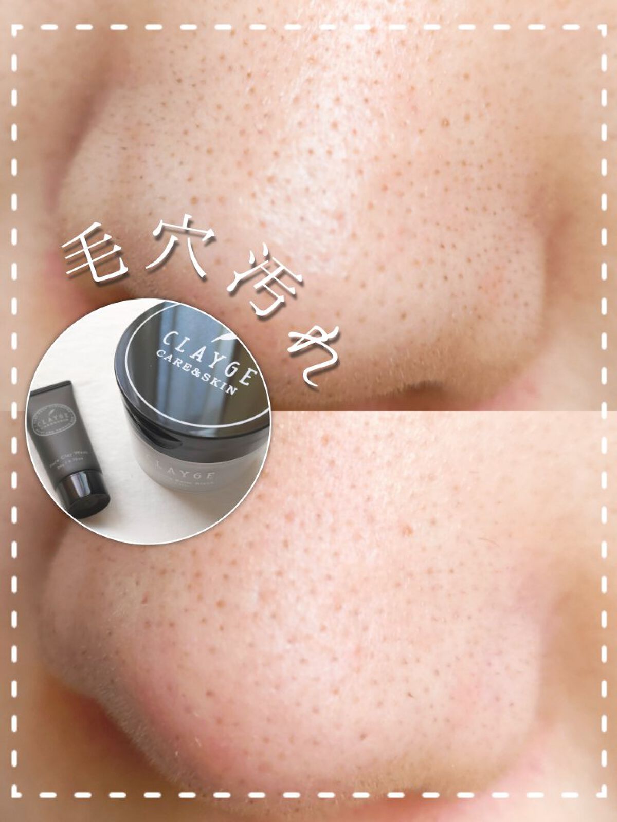 クレンジングバーム ブラック/CLAYGE/クレンジングバームを使ったクチコミ（1枚目）