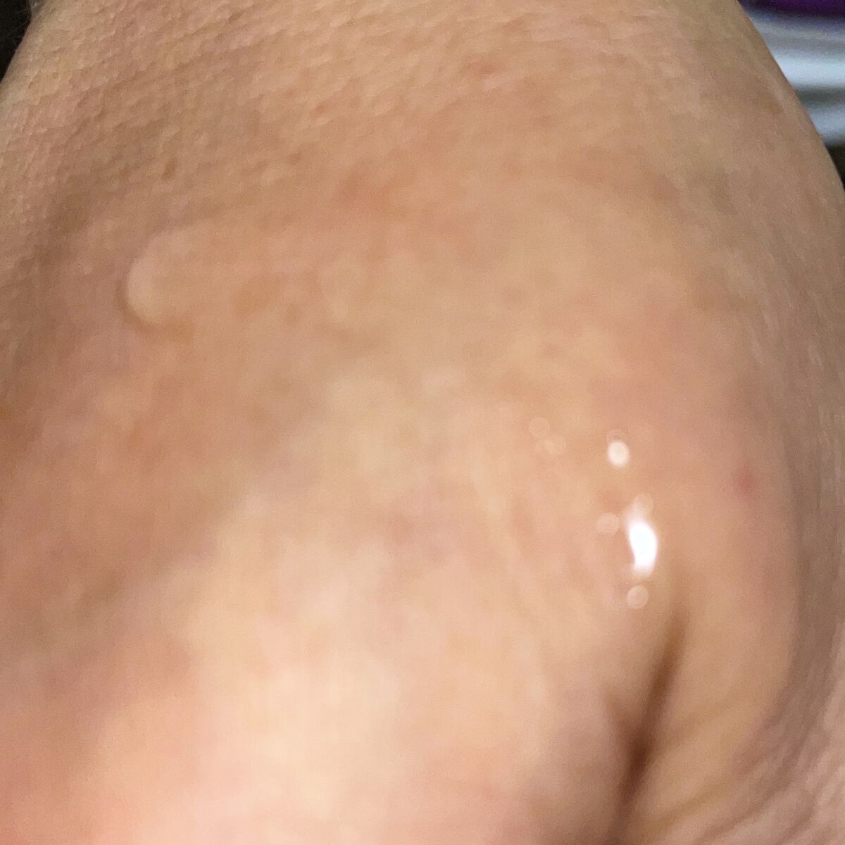 ローヤルゼリー配合 栄養ローション/DAISO/美容液を使ったクチコミ（3枚目）