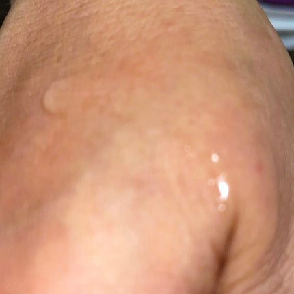 ローヤルゼリー配合 栄養ローション/DAISO/美容液を使ったクチコミ(3枚目)