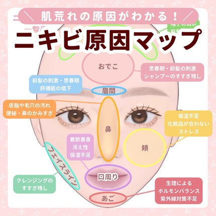 薬用ニキビケア スポッツクリーム/アクネスラボ/フェイスクリームを使ったクチコミ(1枚目)