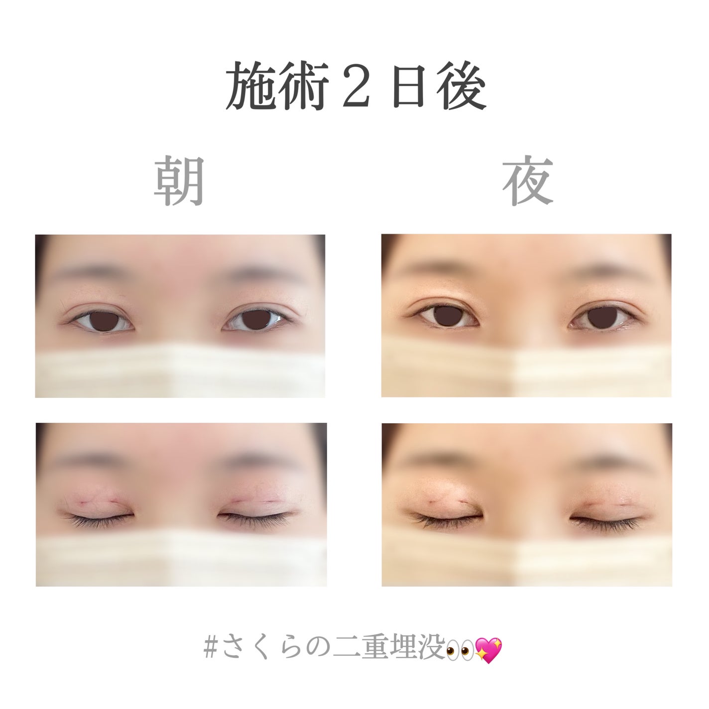 ãããðž on LIPS ãäºéåæ²¡äœéšèšâ¢ðð(æœè¡ç¿æ¥ã10æ¥åŸ)----------..ãïŒ3æç®ïŒ