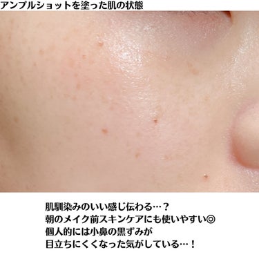 2022年秋新作美容液】モイスチャーライジング コンセントレートグロウ ...