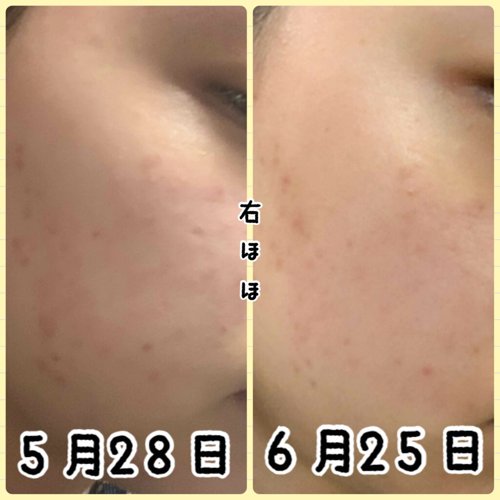 クリアターン ベイビッシュ うるおいマスク/クリアターン/シートマスク・パックを使ったクチコミ（2枚目）