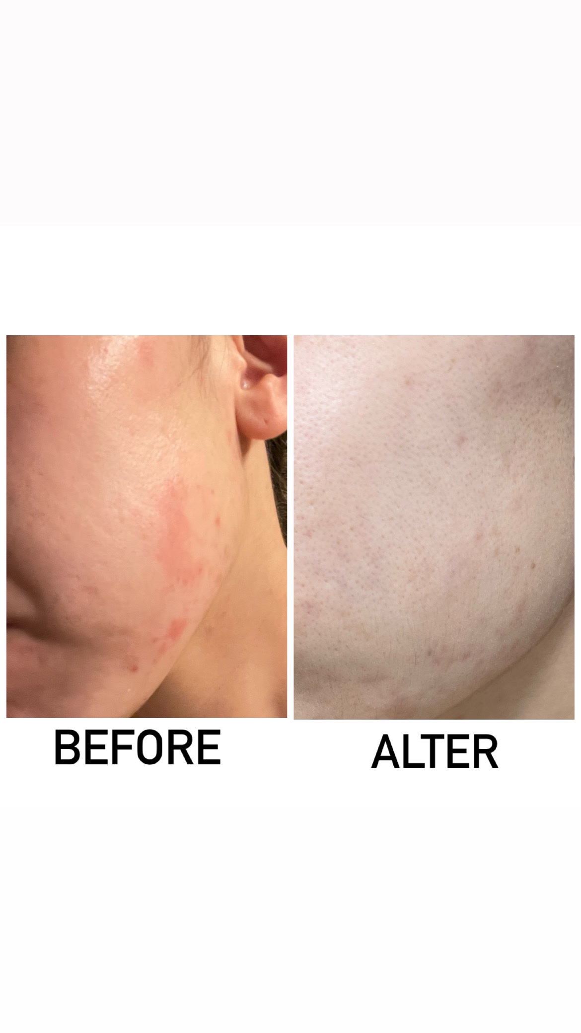 シカクリーム/ASUNE /フェイスクリームを使ったクチコミ（2枚目）