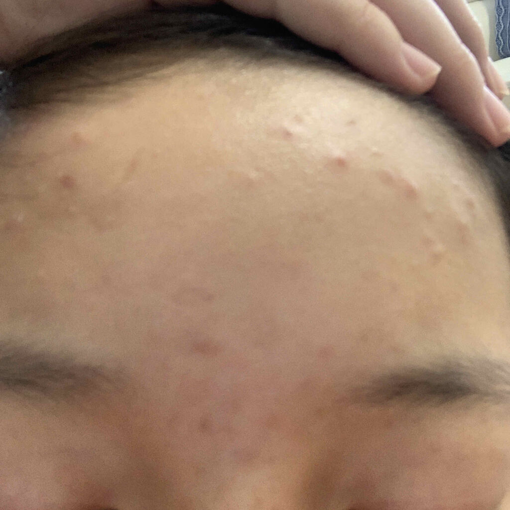 を使ったクチコミ（1枚目）