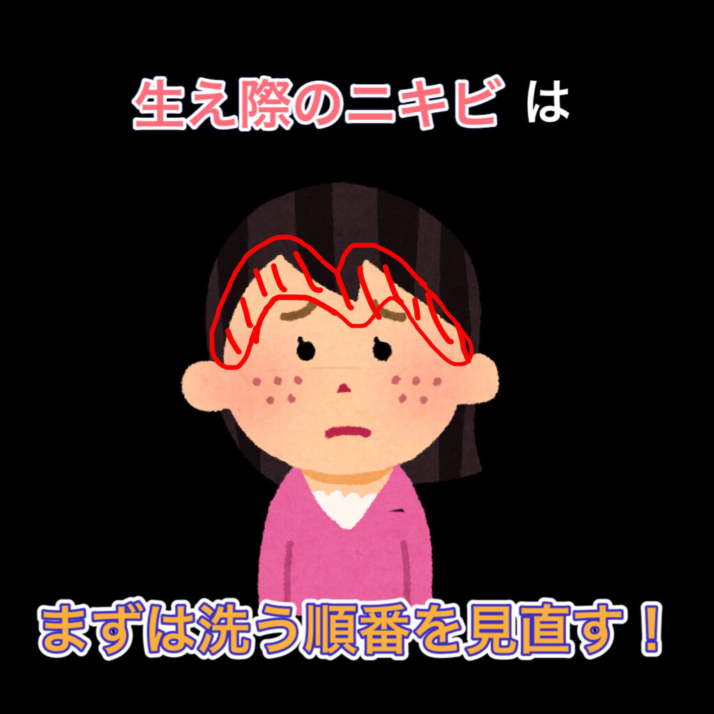 クリューベル　EXクリームマスク(パック)/クリューベル化粧品/フェイスクリームを使ったクチコミ（1枚目）