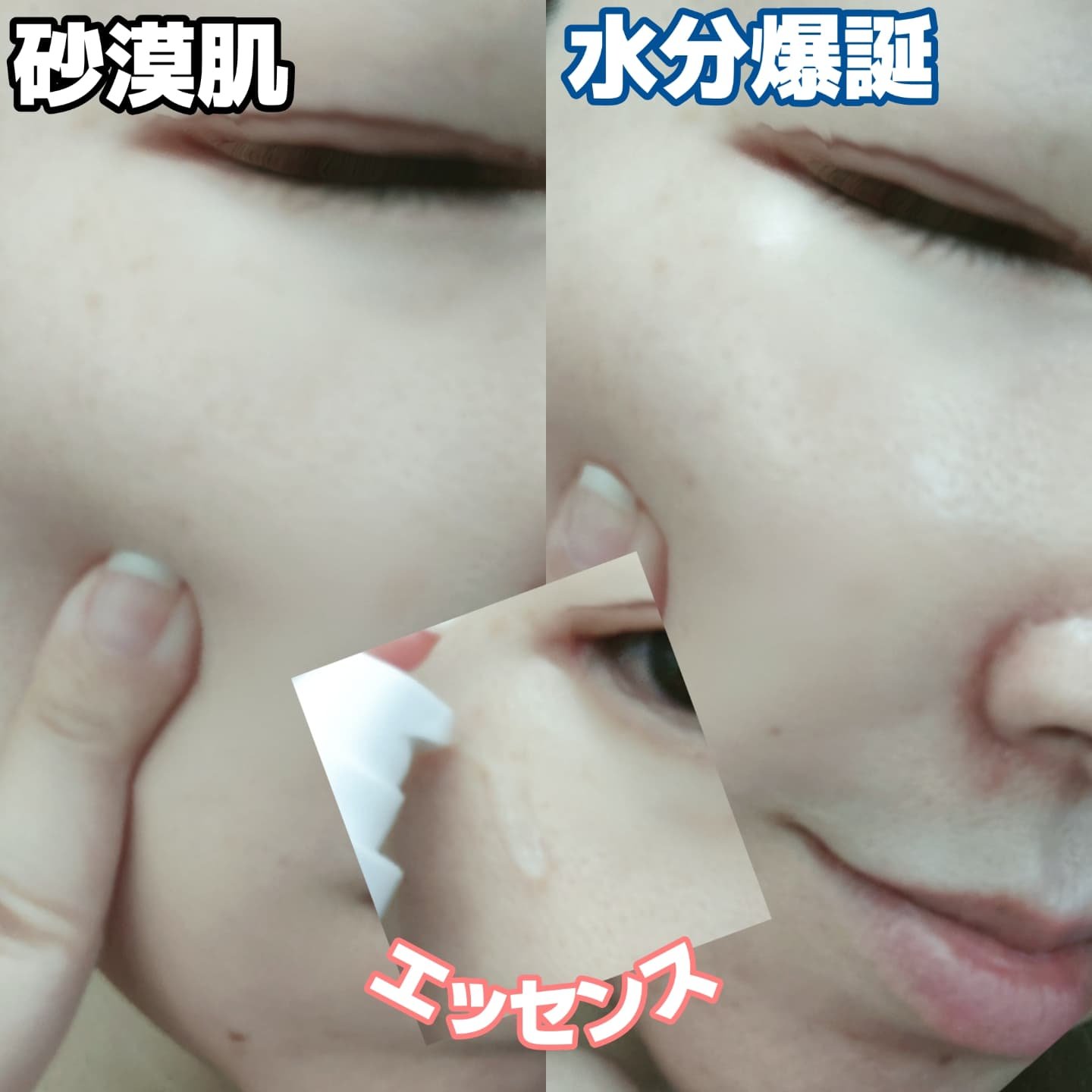 グルカミューンエッセンス /VT/美容液を使ったクチコミ（2枚目）