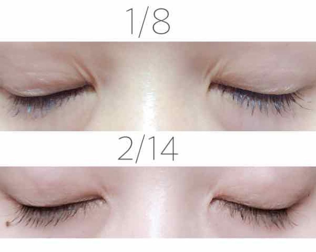 砂糖 on LIPS 「⚠️2枚目以降に目の画像があります⚠️みなさんこんばんは砂糖で..」(2枚目)