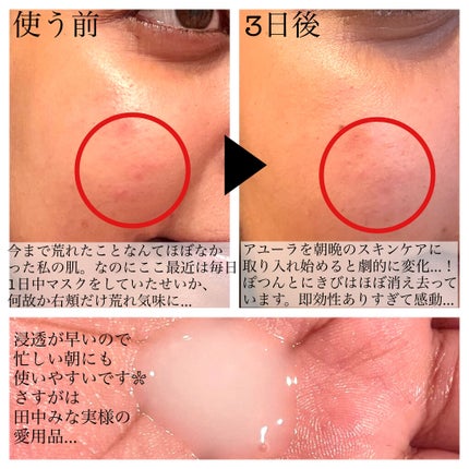 リズムコンセントレートα/AYURA/美容液を使ったクチコミ(4枚目)