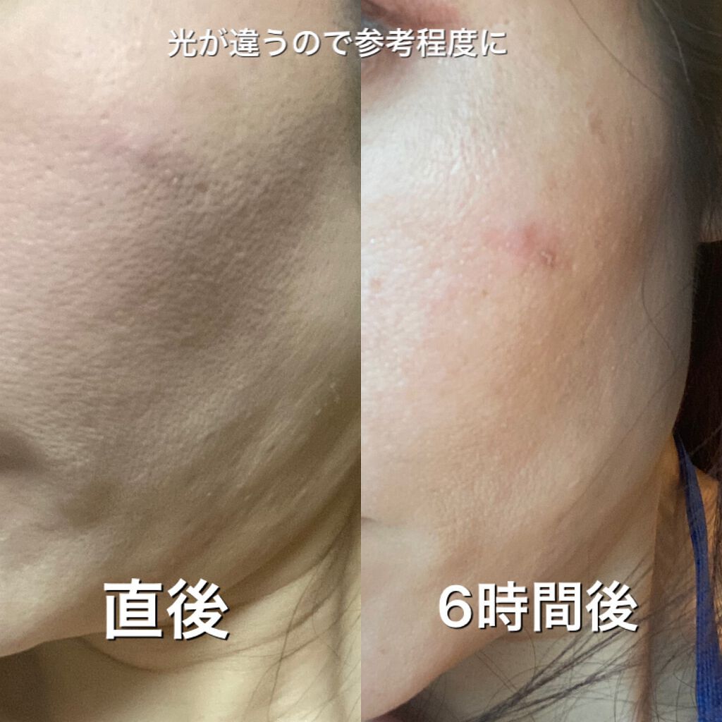 Wエッセンス/shimaboshi/美容液を使ったクチコミ(4枚目)