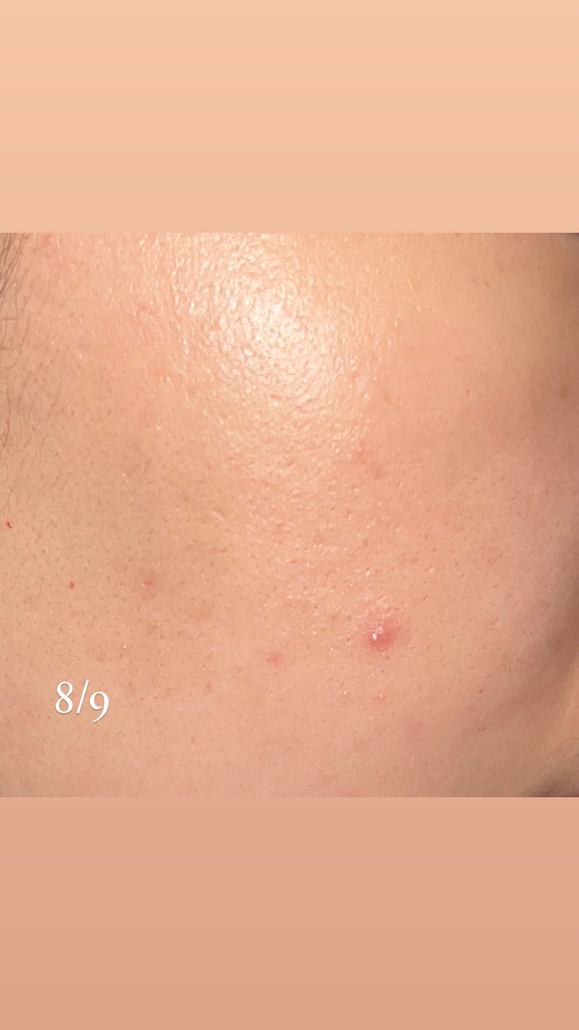 リードルショット100/VT/美容液を使ったクチコミ(3枚目)