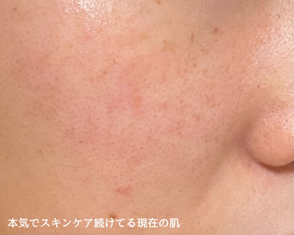 クリアケア化粧水 高保湿タイプ/無印良品/化粧水を使ったクチコミ（3枚目）