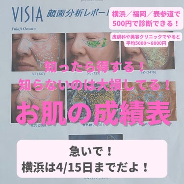 美肌カウンセラー💆綺麗のお助け相談所 on LIPS 「めっちゃ得！お肌診断が200円でできる！しかも、毎月1000人..」（1枚目）