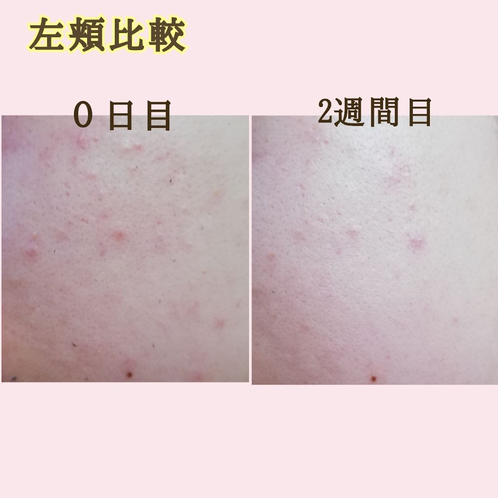 ザ・タイムR アクア/IPSA/化粧水を使ったクチコミ(3枚目)