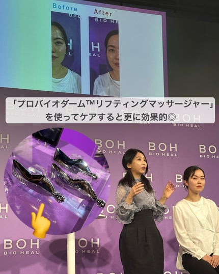 バイオヒールボ プロバイオダーム 3Dリフティングクリーム/BIOHEAL BOH/フェイスクリームを使ったクチコミ(4枚目)