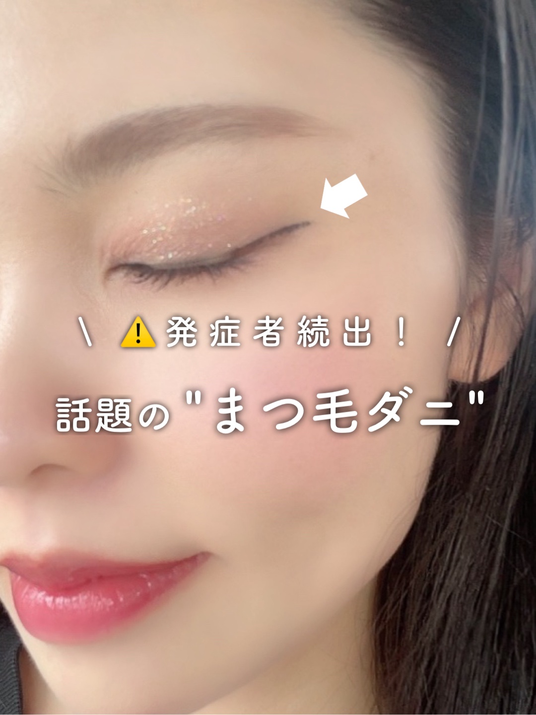 今話題の「まつ毛ダニ」　 2人に1人がなってる大流行中の危険な病⚡️⚡️

 最悪の場合、視力の低下に繋がるみたい😥

 まつ毛ダニの特徴や確認方法、NG行動などは 投稿画像で要チェック！！

 私もこれを機にコスメ断捨離してたら、 使用