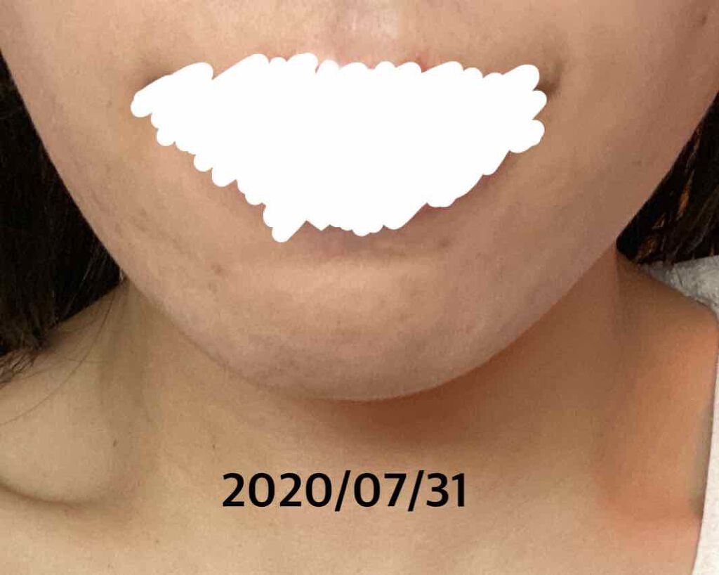 クラリファイング ローション 2/CLINIQUE/拭き取り化粧水を使ったクチコミ(4枚目)