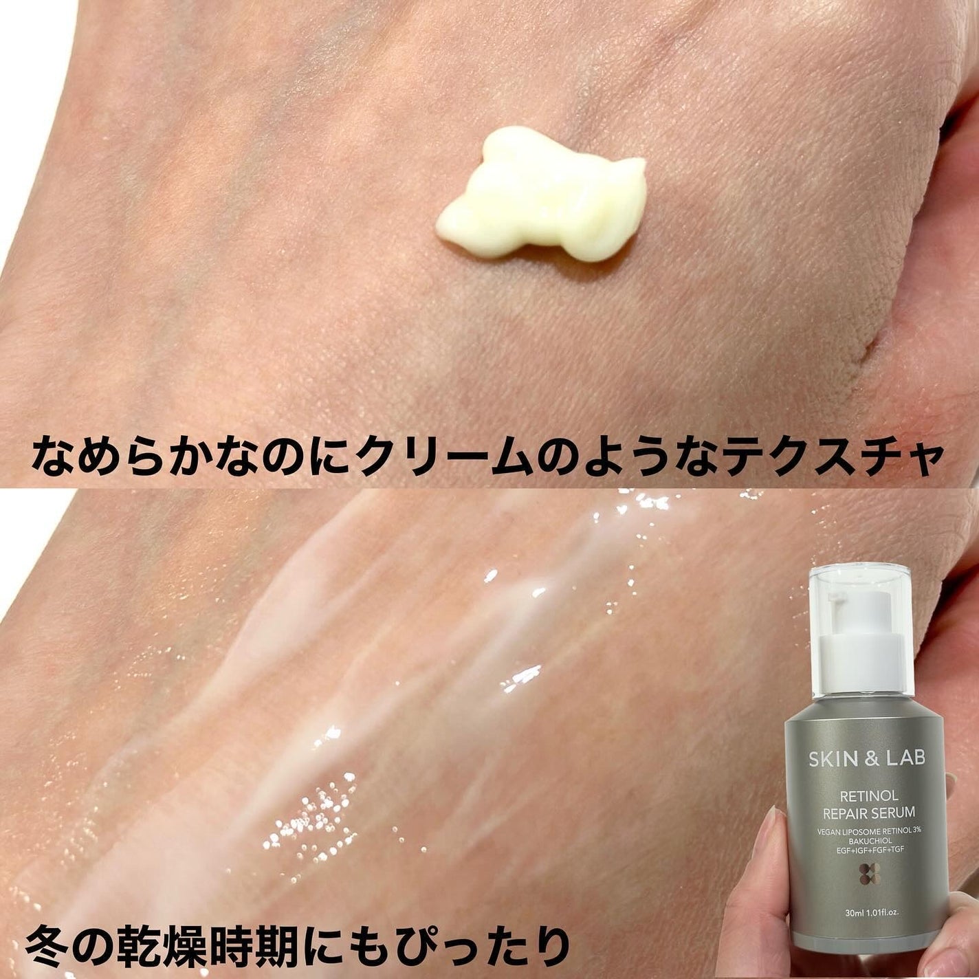 ヴィーガンリポソームレチノールセラム/SKIN&LAB/美容液を使ったクチコミ(6枚目)