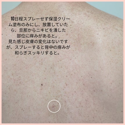 レッドアクネ ボディピーリングショット/MEDICUBE/ピーリングを使ったクチコミ(10枚目)