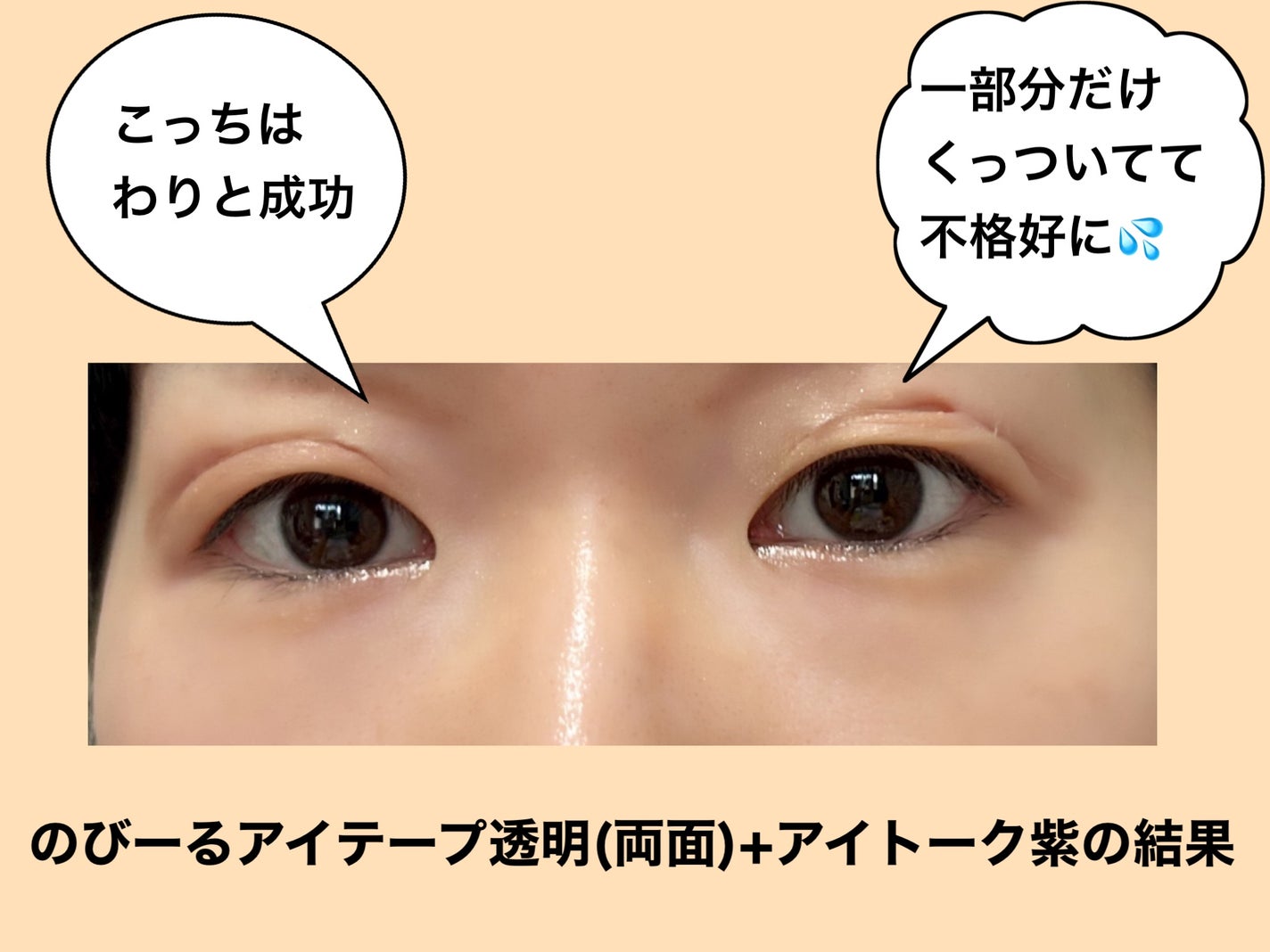 のび〜る アイテープ 両面テープタイプ/DAISO/二重まぶた用アイテムを使ったクチコミ(3枚目)