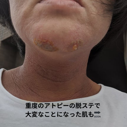 美肌カウンセラー💆肌悩みを解決し見る世界を変える on LIPS 「いま、肌のことで悩んでいても大丈夫!これを見たら絶対に希望がも..」(8枚目)