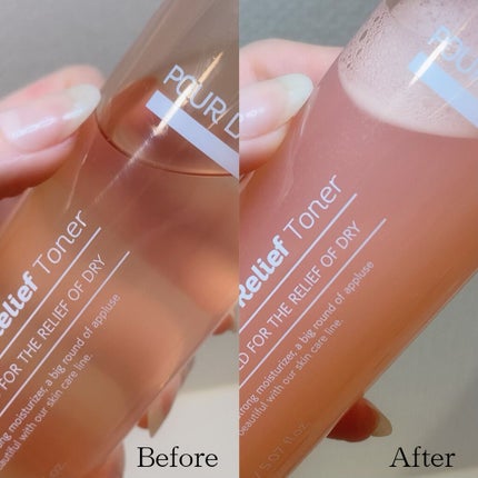 カラミンスキン レリーフトナー/pour LA PEAU/化粧水を使ったクチコミ(3枚目)