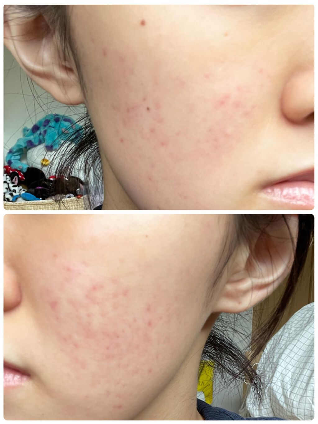 白潤プレミアム薬用浸透美白化粧水/肌ラボ/化粧水を使ったクチコミ（2枚目）