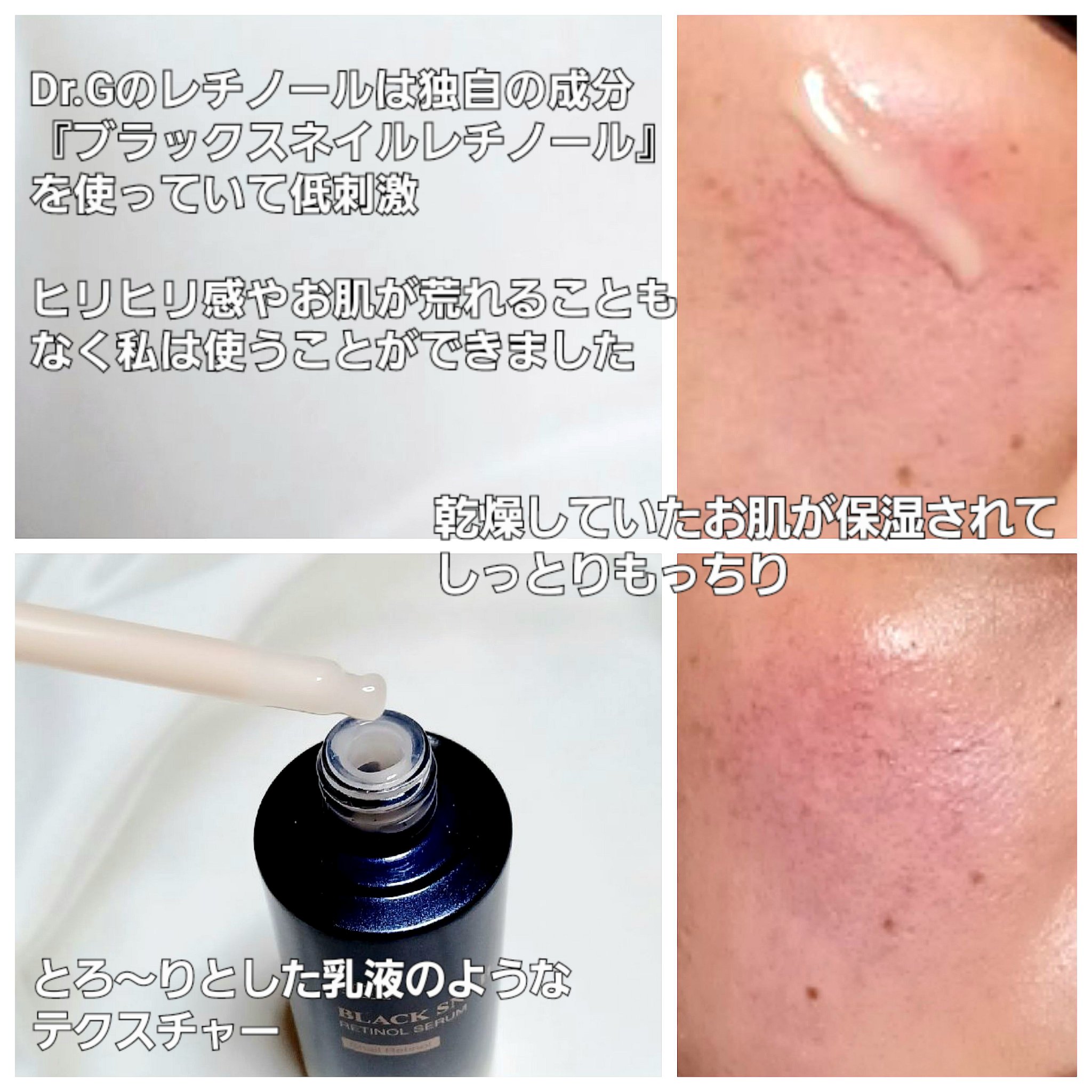 ブラックスネイルレチノールセラム/Dr.G/美容液を使ったクチコミ（2枚目）