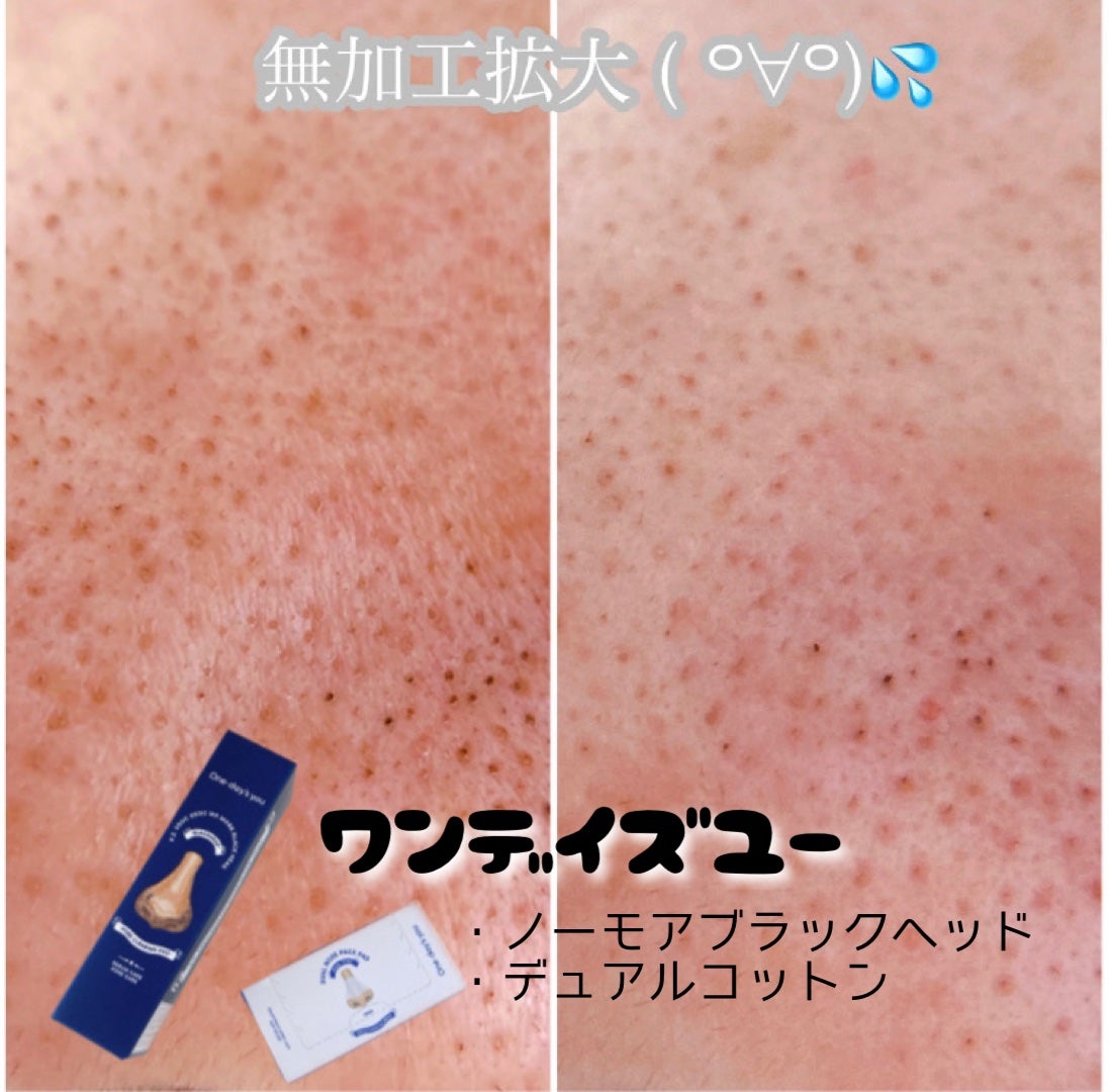 ノーモアブラックヘッド(ノーズピーリング)/One-day's you/スクラブ・ゴマージュを使ったクチコミ(2枚目)