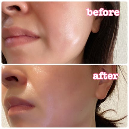 リファイン 3ステップフェイスマスク/REJURAN COSMETICS/シートマスク・パックを使ったクチコミ(9枚目)