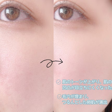 オルビスユー トリートメントプライマー/オルビス/化粧下地を使ったクチコミ(5枚目)