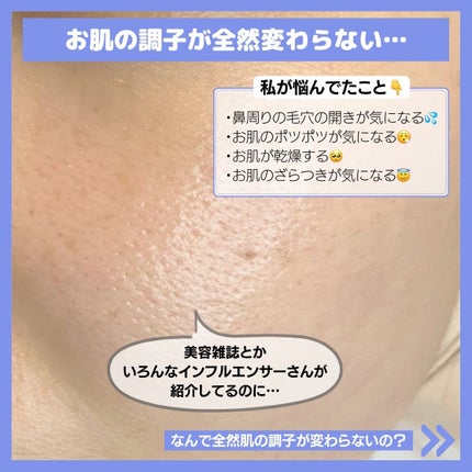 タカミスキンピール/タカミ/ブースター・導入液を使ったクチコミ(3枚目)
