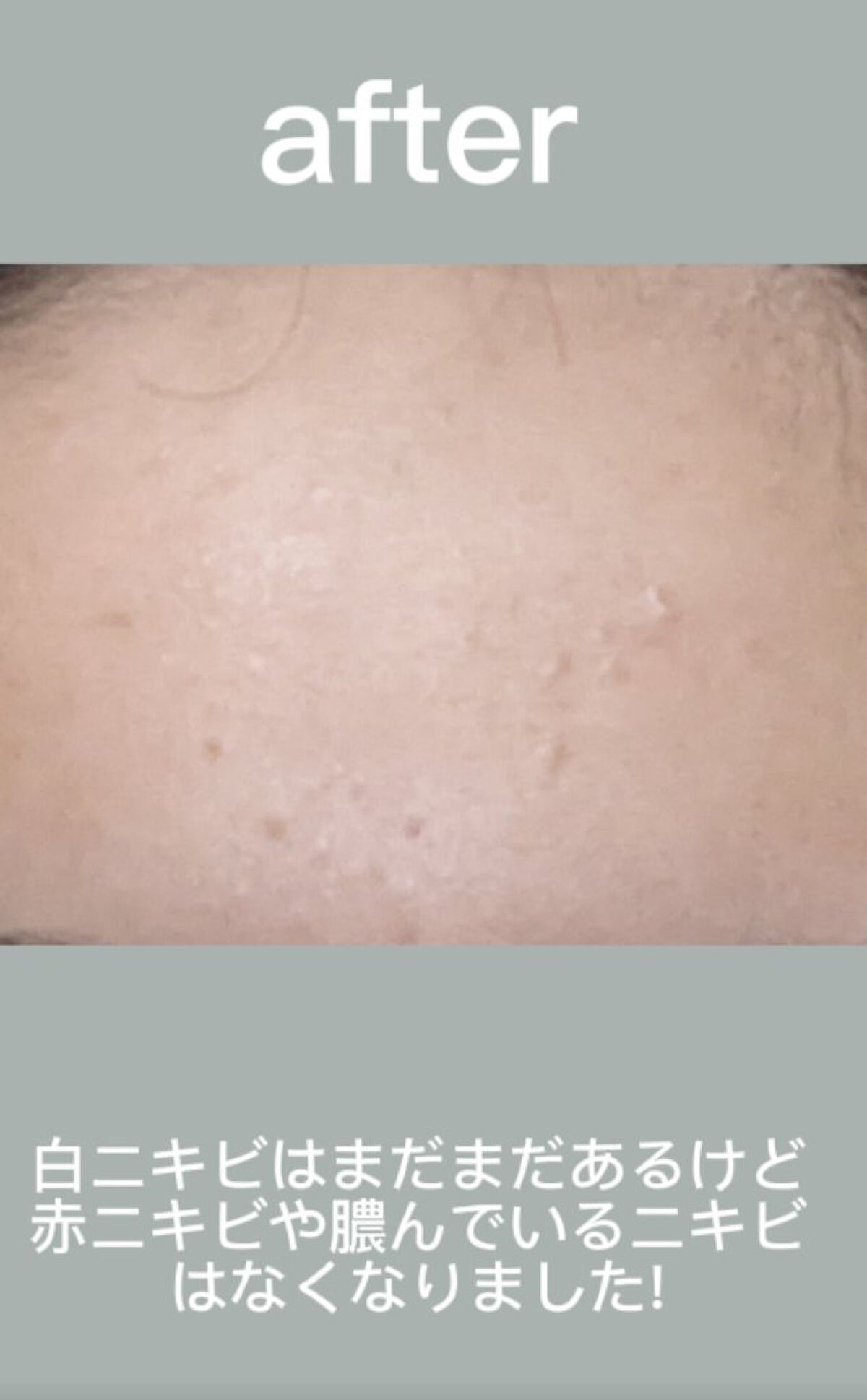 ハトムギ保湿ジェル(ナチュリエ スキンコンディショニングジェル)/ナチュリエ/美容液を使ったクチコミ（3枚目）