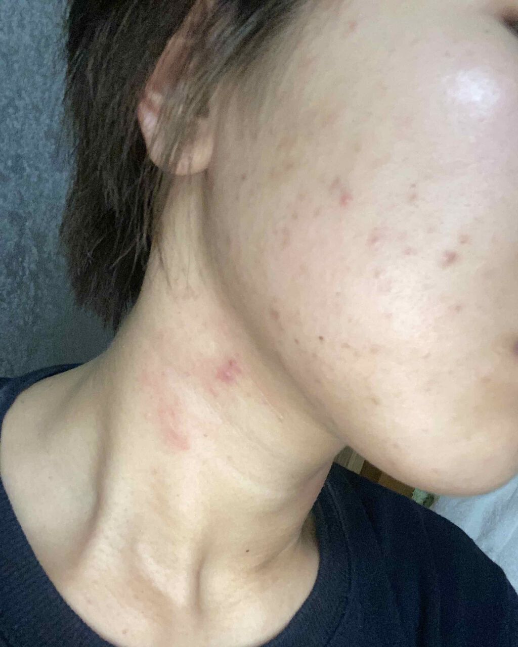 コンディショニングウォッシュ/d プログラム/洗顔フォームを使ったクチコミ（3枚目）