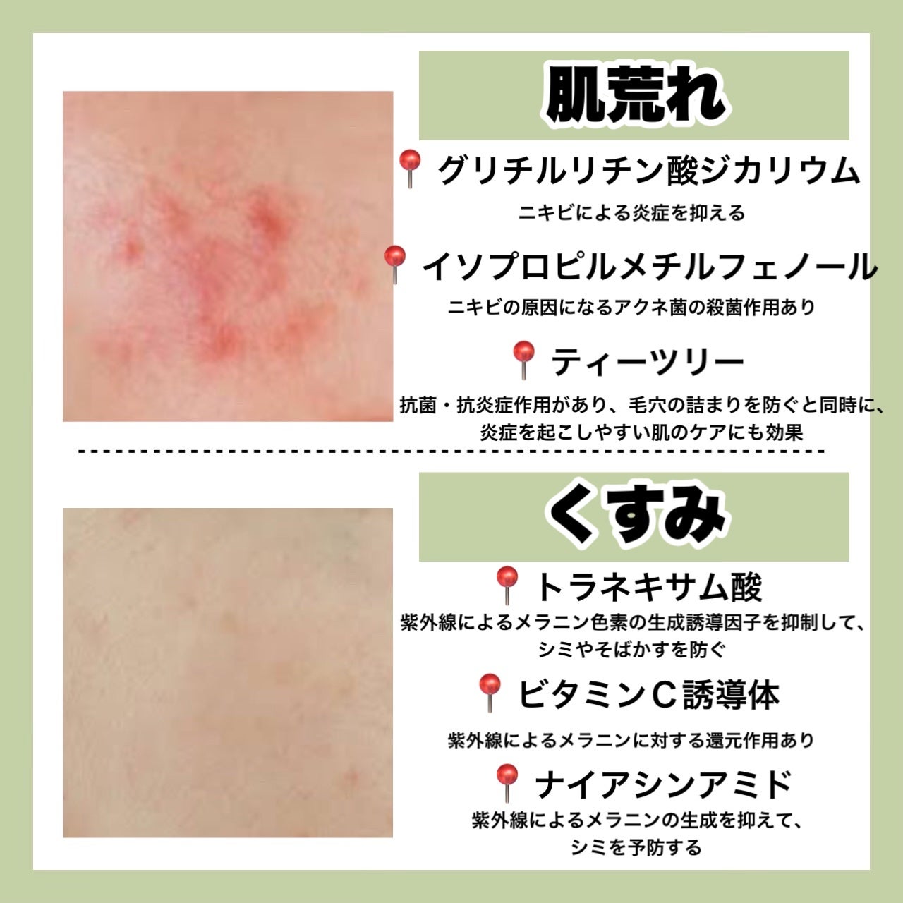 ハトムギ化粧水(ナチュリエ スキンコンディショナー R )/ナチュリエ/化粧水を使ったクチコミ(4枚目)