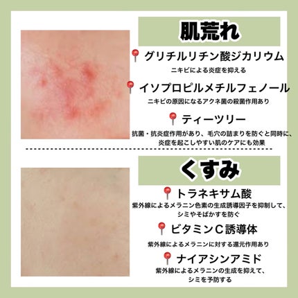 ハトムギ化粧水(ナチュリエ スキンコンディショナー R )/ナチュリエ/化粧水を使ったクチコミ(4枚目)