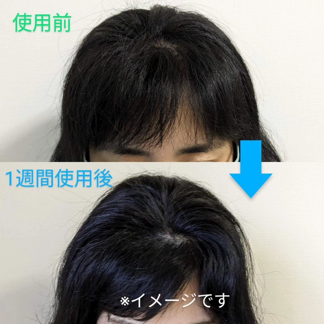 薬用育毛剤 KAMINOWA/KAMINOWA/頭皮ローションを使ったクチコミ(3枚目)