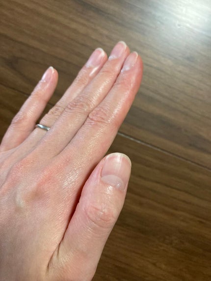 薬用 クリアストロングショット アルファ/北の快適工房/レッグ・フットケアを使ったクチコミ(5枚目)