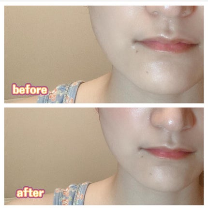 SAIBOW セラム/ドクターソワ/美容液を使ったクチコミ(5枚目)