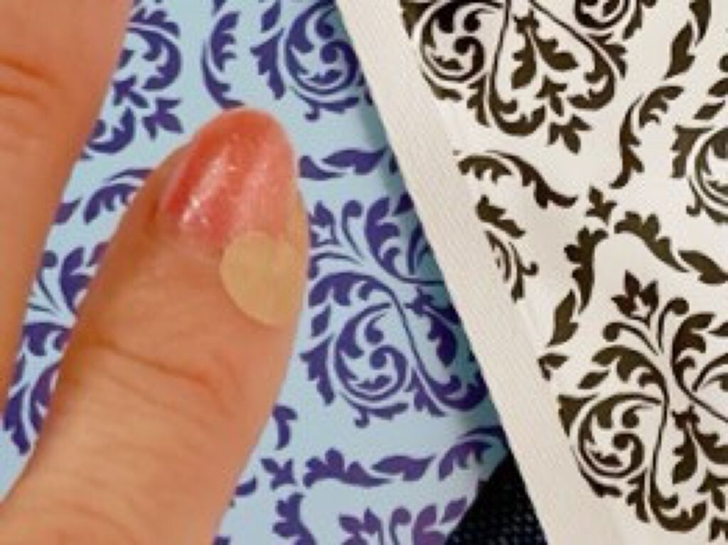 ささない鍼アキュライフ/ペネロピムーン/その他を使ったクチコミ（1枚目）