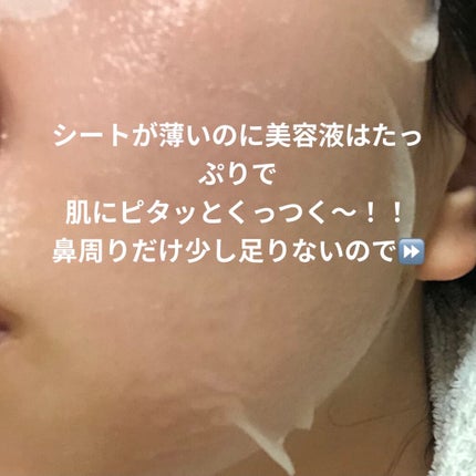 ルルルンワンナイト レスキュー保湿(旧品)/ルルルン/シートマスク・パックを使ったクチコミ(2枚目)