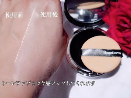 ひだまり@毎日投稿✨ on LIPS 「エステサロンでも大人気の今話題沸騰中の韓国コスメブランド..」(4枚目)