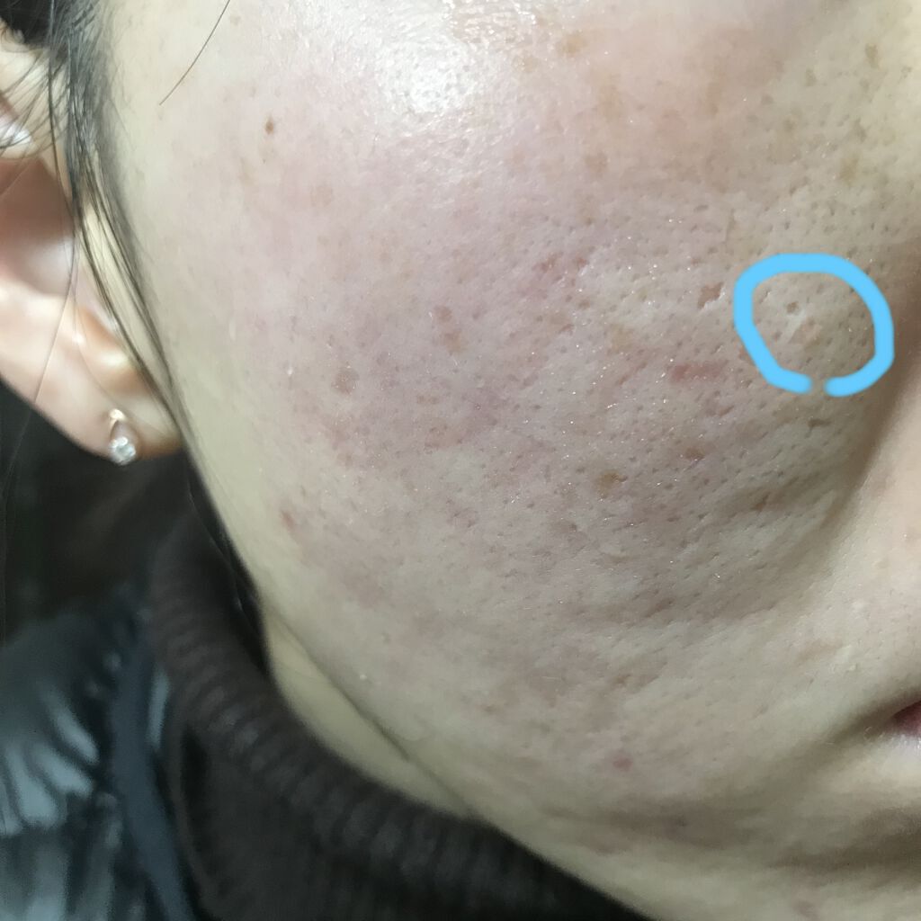 ドクタージャルト シカペア リカバー (第2世代）/Dr.Jart＋/フェイスクリームを使ったクチコミ（3枚目）